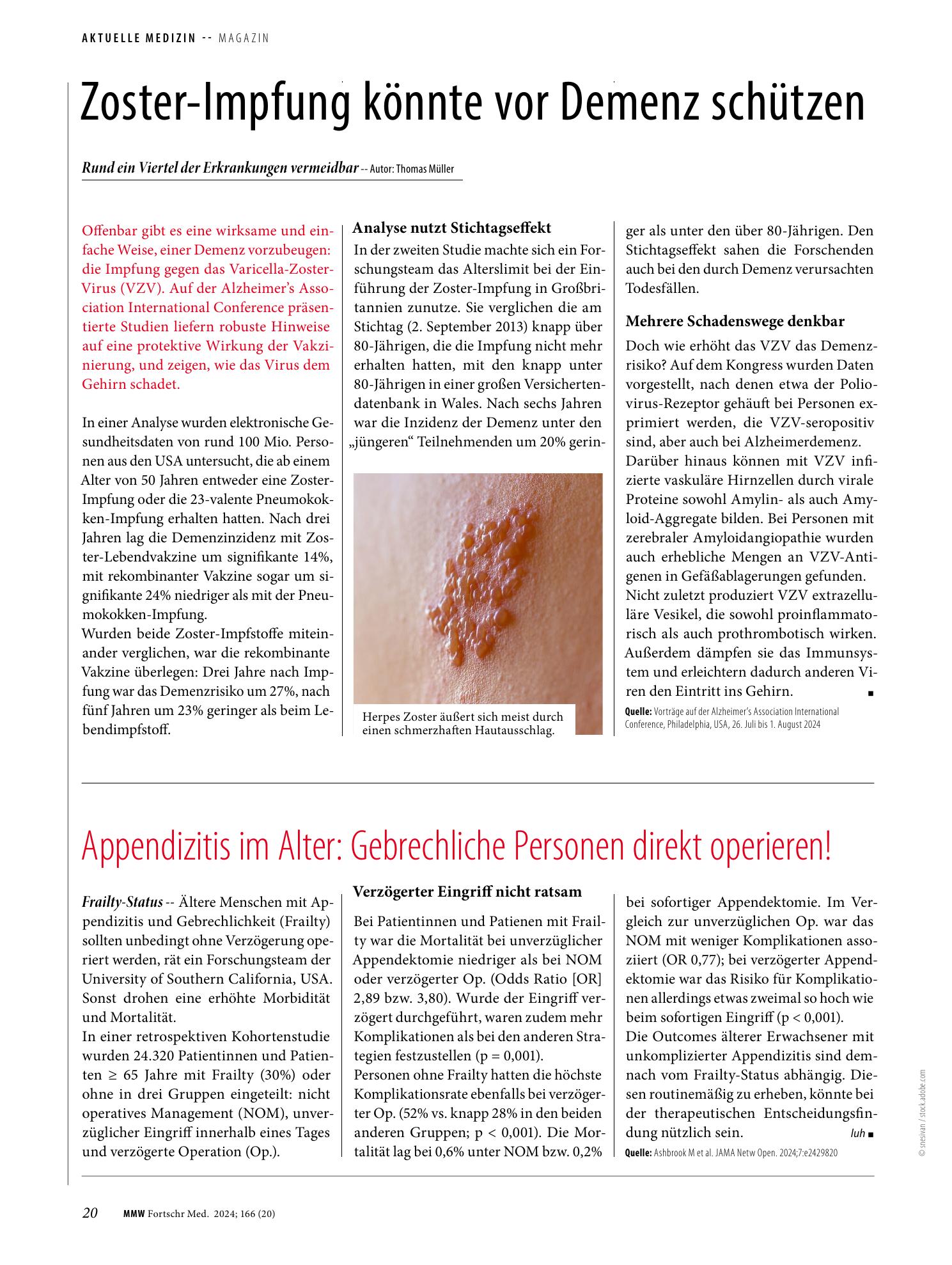 Vorschauseite 1: Appendizitis im Alter: Gebrechliche Personen direkt operieren!