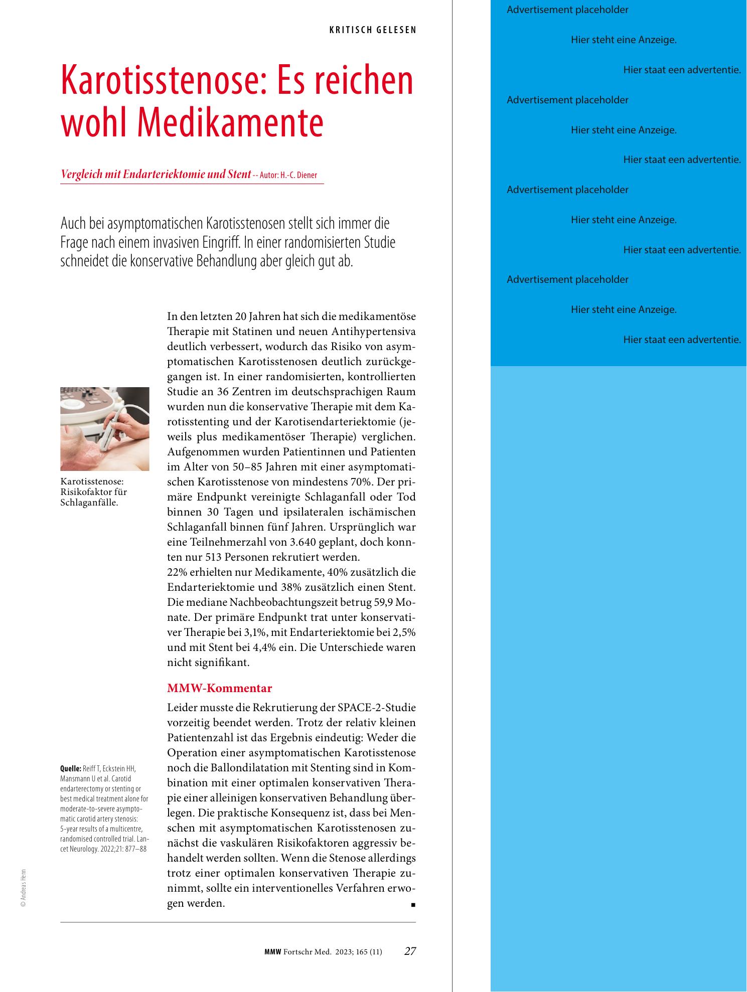 Vorschauseite 1: Karotisstenose: Es reichen wohl Medikamente