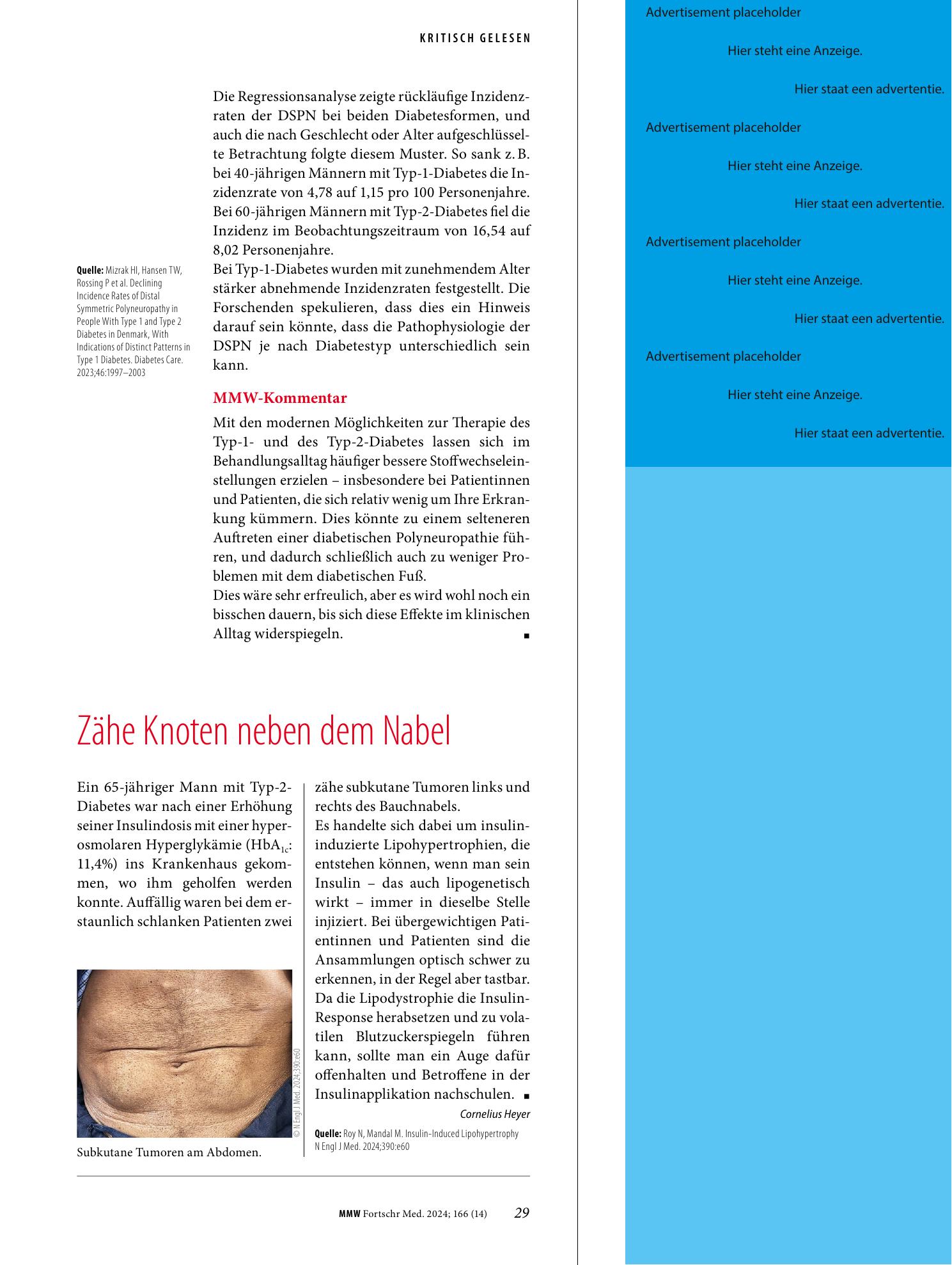 Vorschauseite 1: Zähe Knoten neben dem Nabel