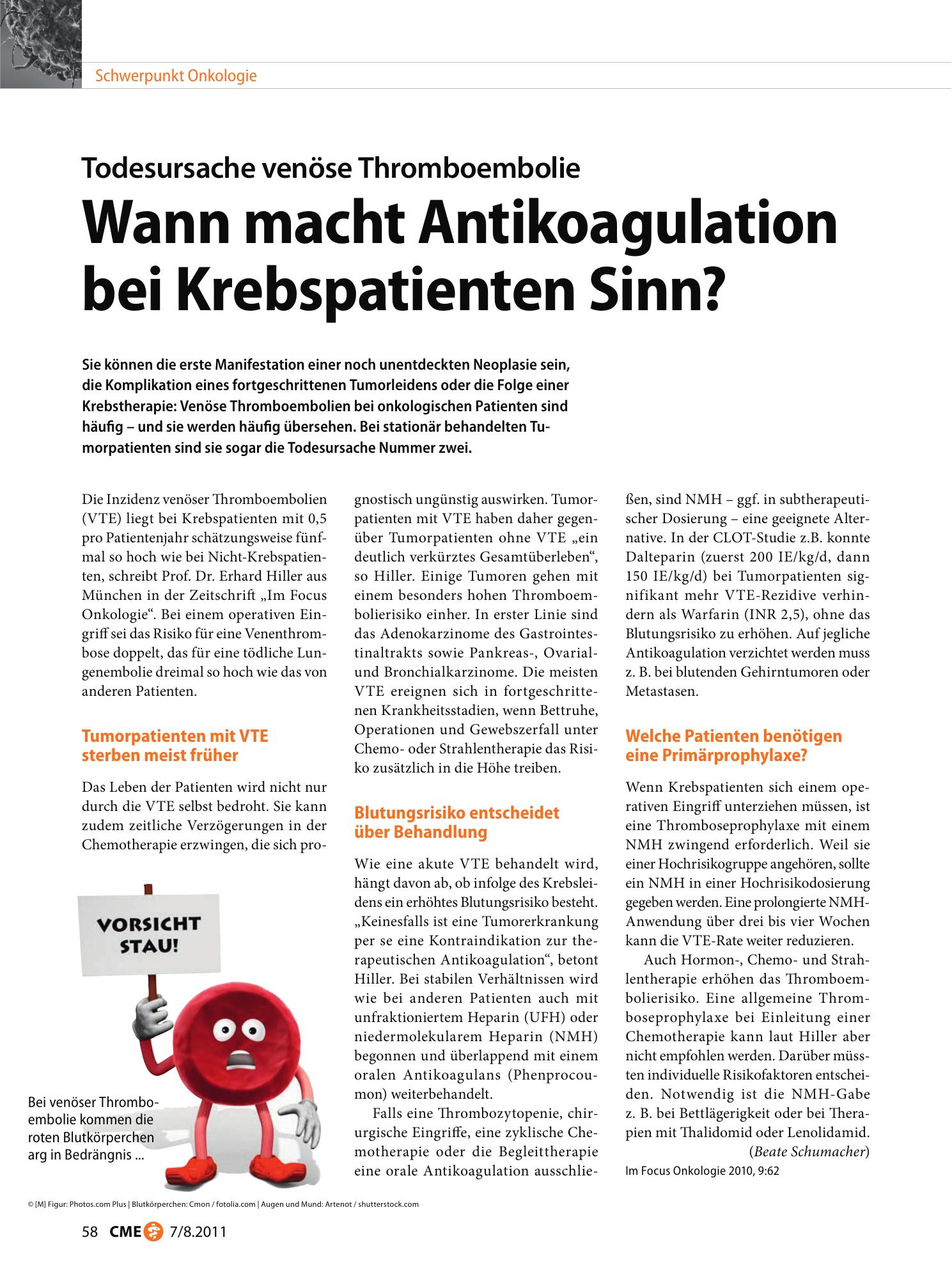 Vorschauseite 1: Wann macht Antikoagulation bei Krebspatienten Sinn?
