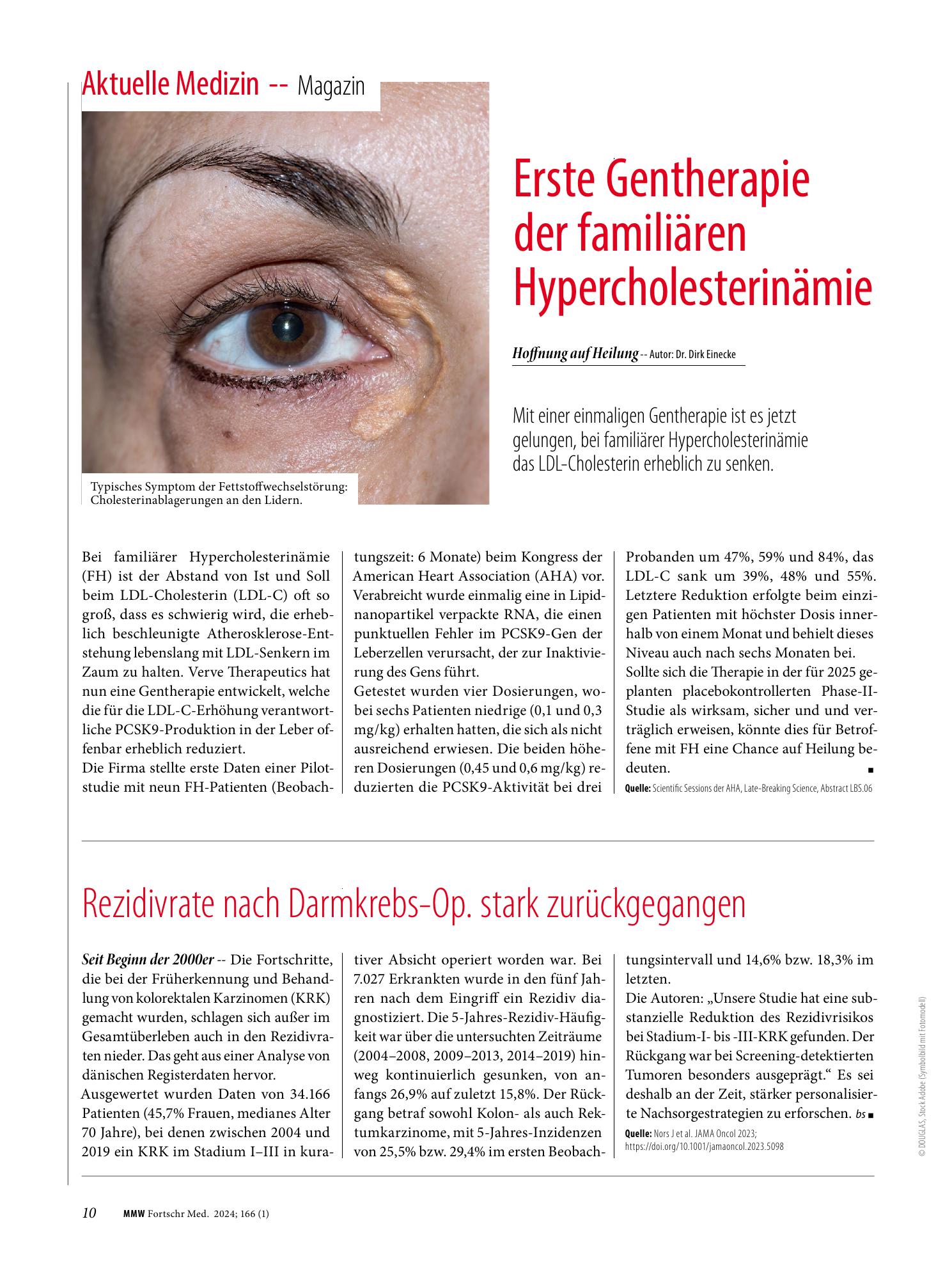 Vorschauseite 1: Erste Gentherapie der familiären Hypercholesterinämie