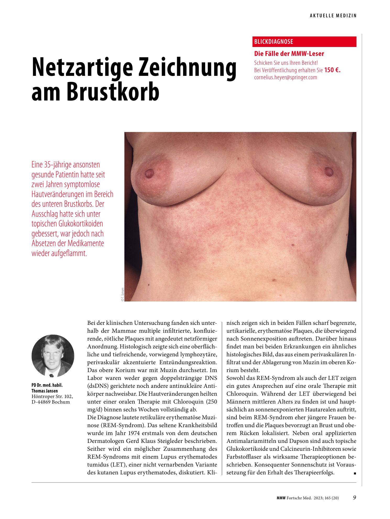 Vorschauseite 1: Netzartige Zeichnung am Brustkorb