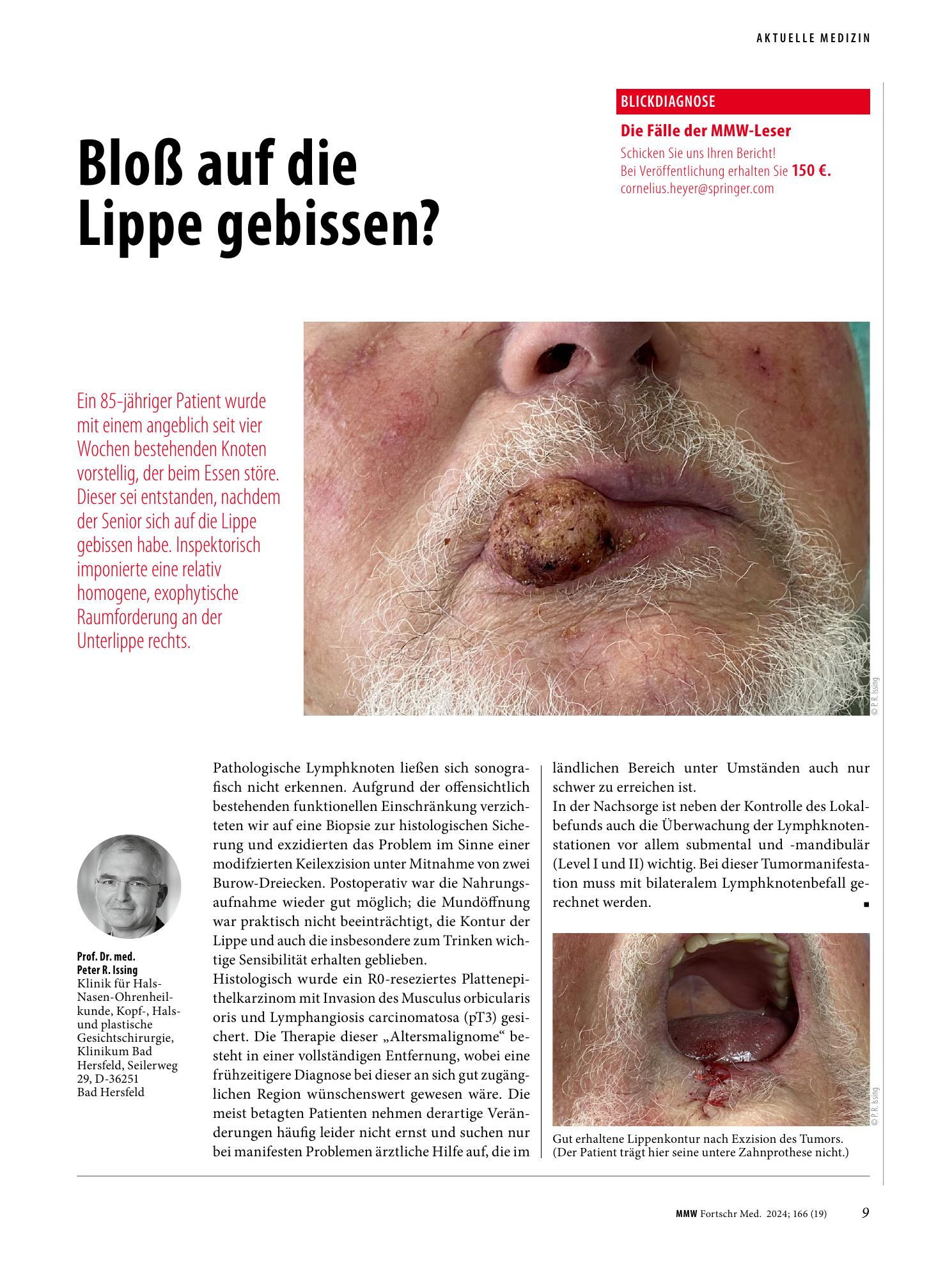 Vorschauseite 1: Bloß auf die Lippe gebissen?