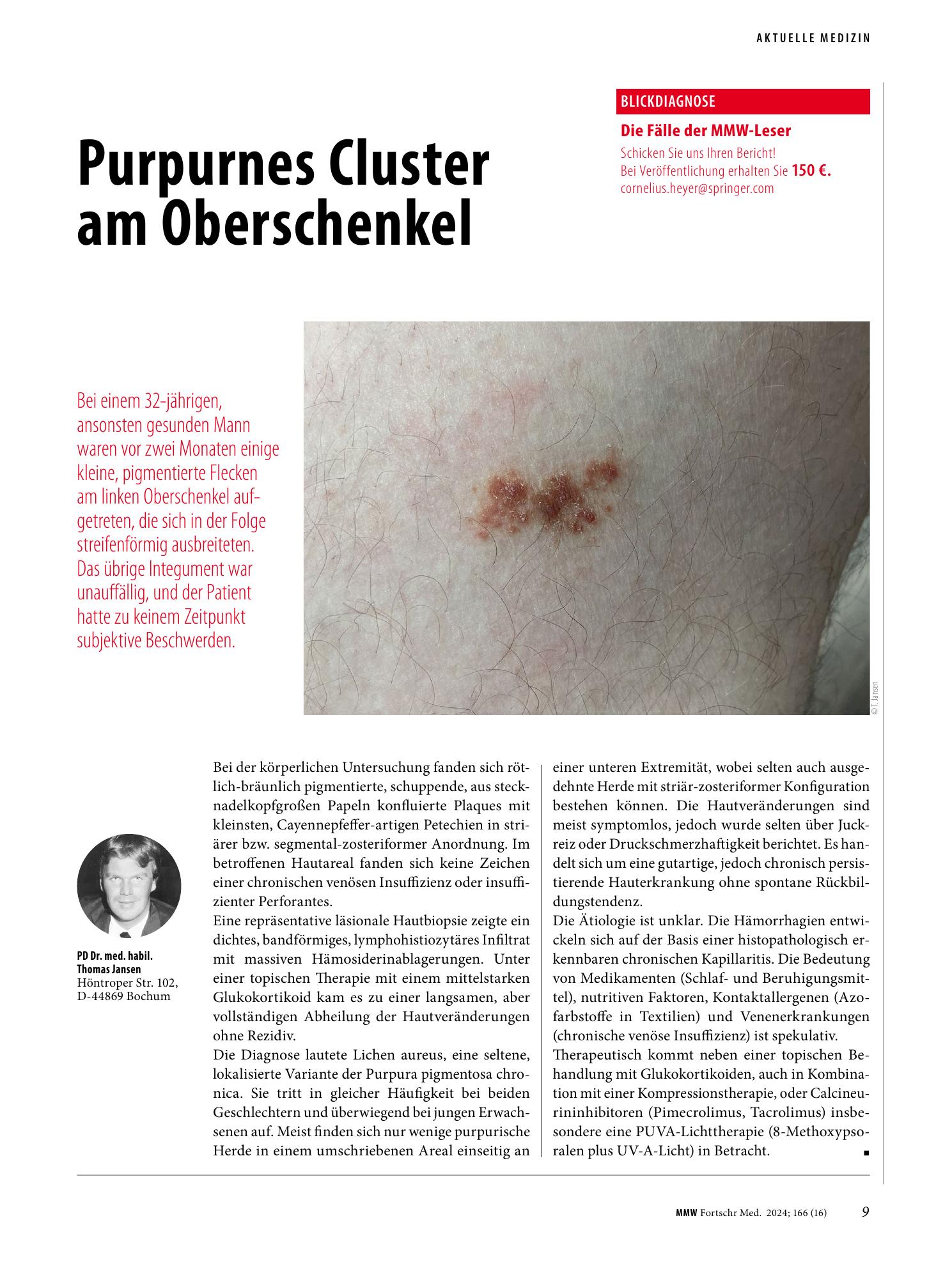 Vorschauseite 1: Purpurnes Cluster am Oberschenkel