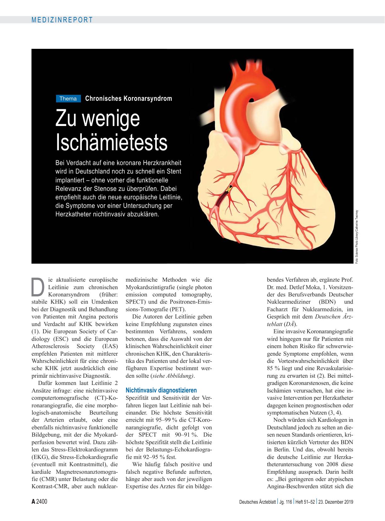 Vorschauseite 1: Chronisches Koronarsyndrom: Zu wenige Ischämietests