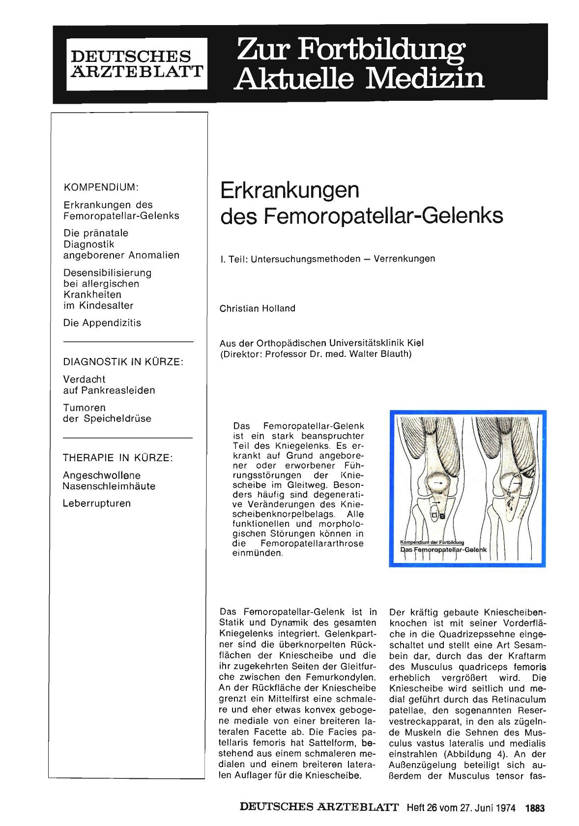 Vorschauseite 1: Erkrankungen des Femoropatellar-Gelenks