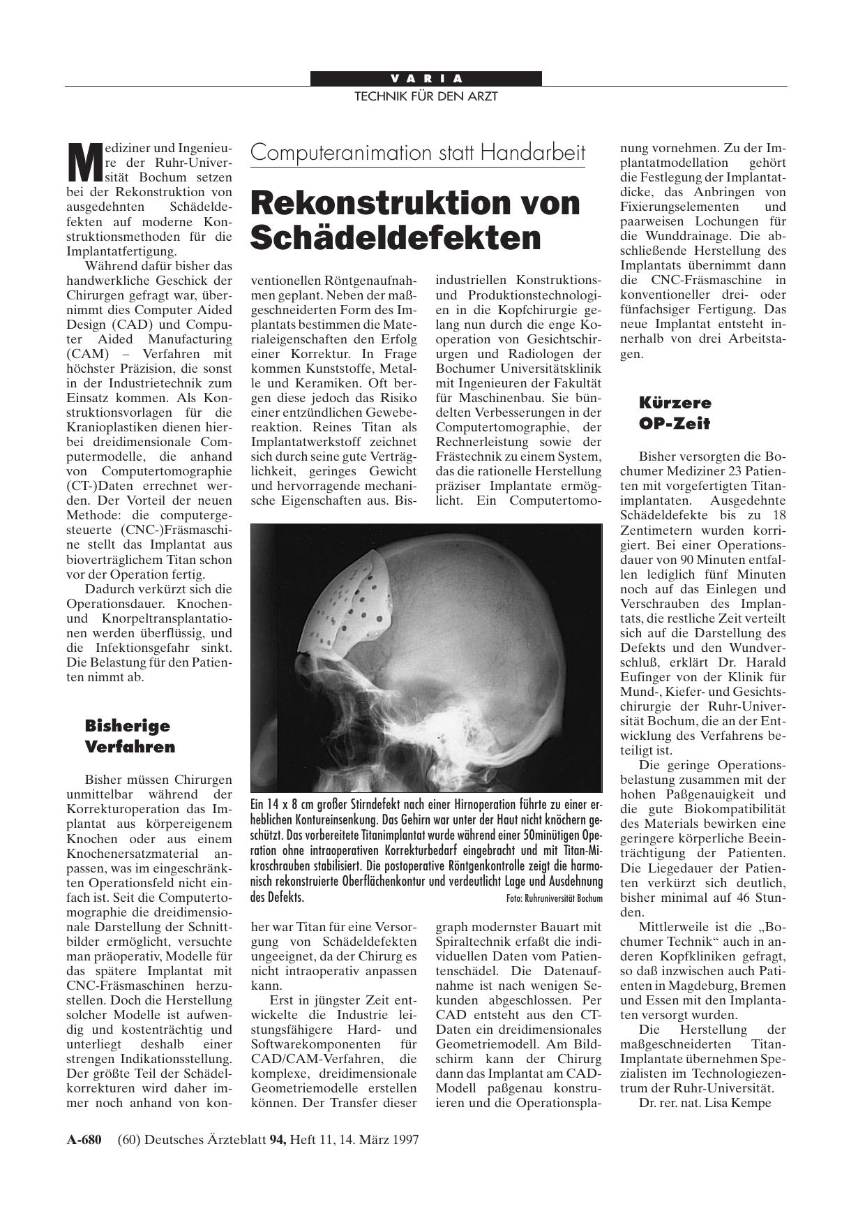 Vorschauseite 1: Computeranimation statt Handarbeit: Rekonstruktion von Schädeldefekten