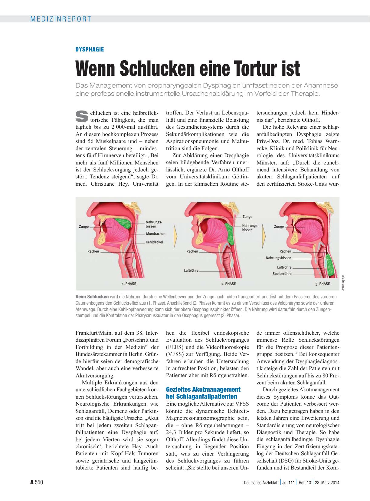 Vorschauseite 1: Dysphagie: Wenn Schlucken eine Tortur ist