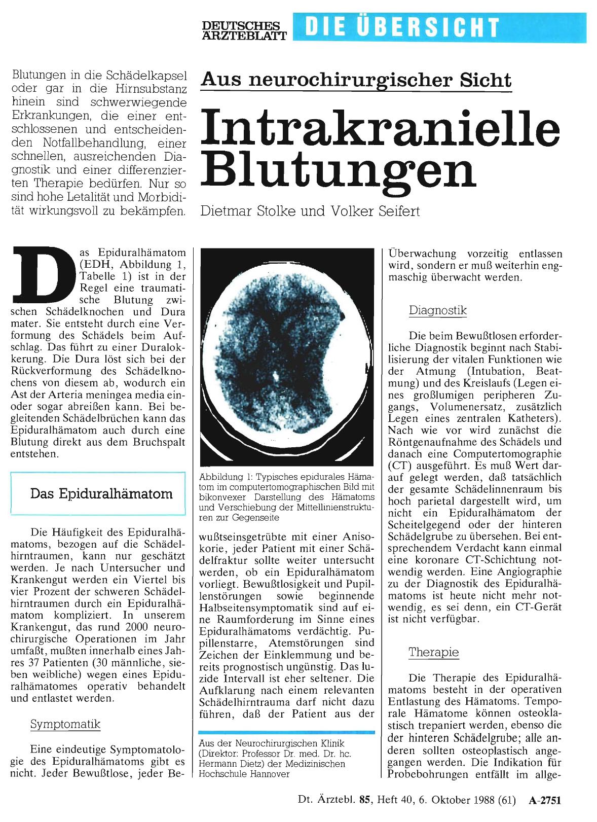 Vorschauseite 1: Aus neurochirurgischer Sicht: Intrakranielle Blutungen