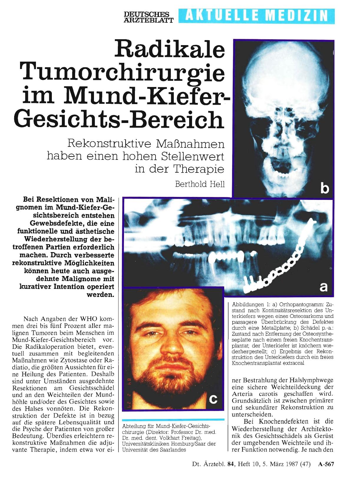 Vorschauseite 1: Radikale Tumorchirurgie im Mund-Kiefer-Gesichts-Bereich