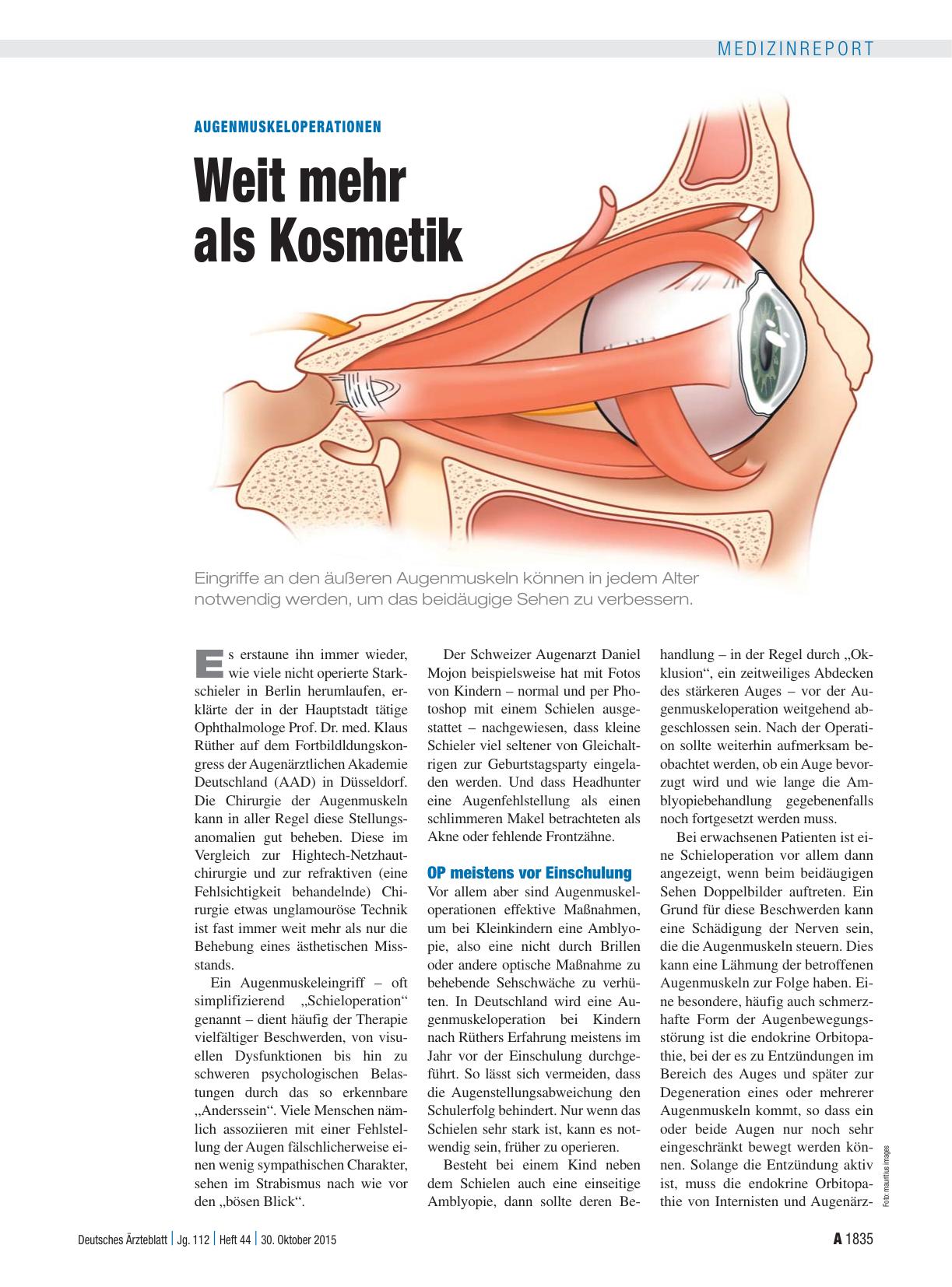 Vorschauseite 1: Augenmuskeloperationen: Weit mehr als Kosmetik