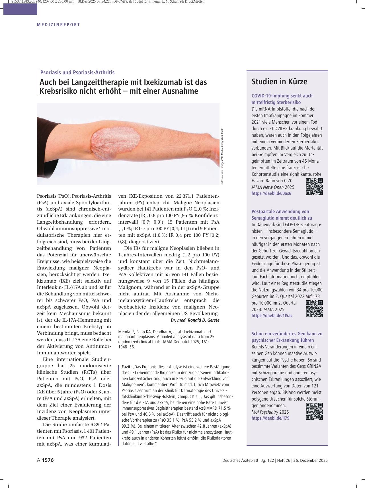 Vorschauseite 1: Psoriasis und Psoriasis-Arthritis: Auch bei Langzeittherapie mit Ixekizumab ist das Krebsrisiko nicht erhöht – mit einer Ausnahme