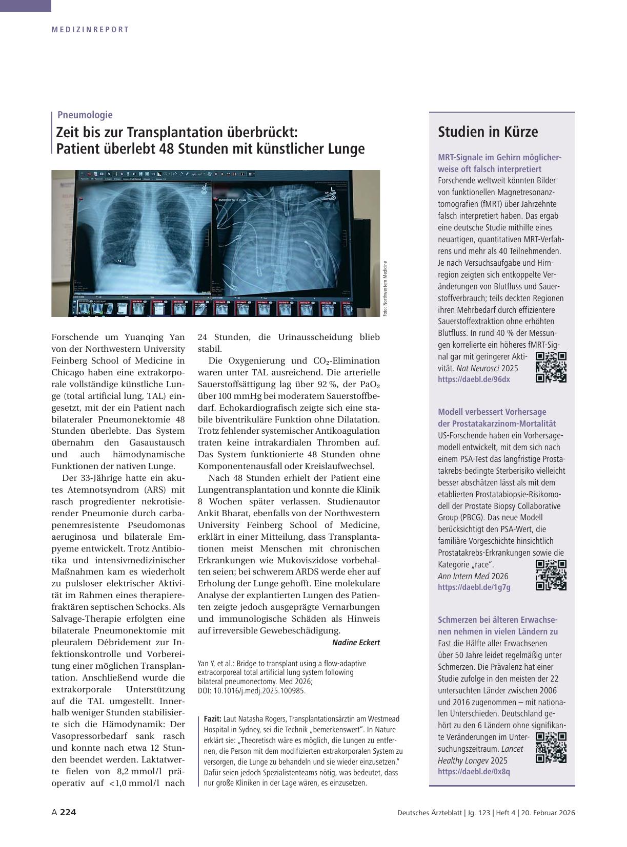 Vorschauseite 1: Pneumologie: Zeit bis zur Transplantation überbrückt — Patient überlebt 48 Stunden mit künstlicher Lunge
