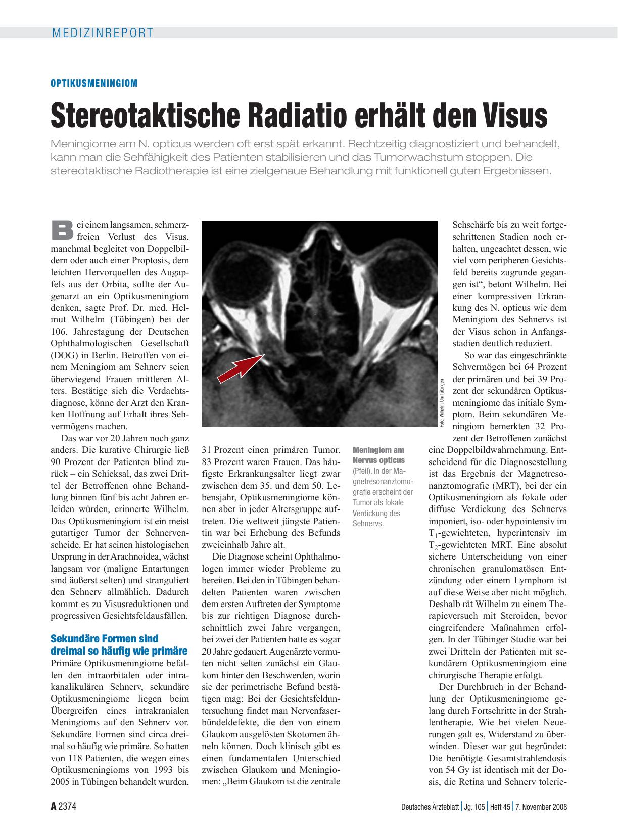 Vorschauseite 1: Optikusmeningiom: Stereotaktische Radiatio erhält den Visus