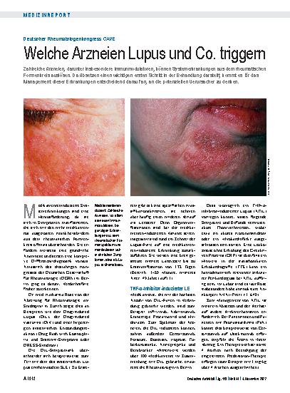 Vorschauseite 1: Deutscher Rheumatologenkongress CAVE: Welche Arzneien Lupus und Co. triggern