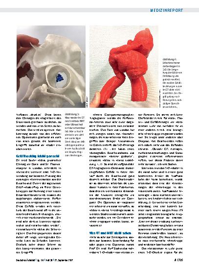 Vorschauseite 2: Anatomische Rekonstruktion: 3-D-Drucker erobern den OP-Saal