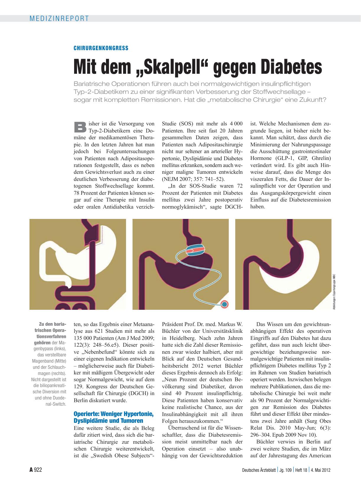 Vorschauseite 1: Chirurgenkongress: Mit dem „Skalpell“ gegen Diabetes