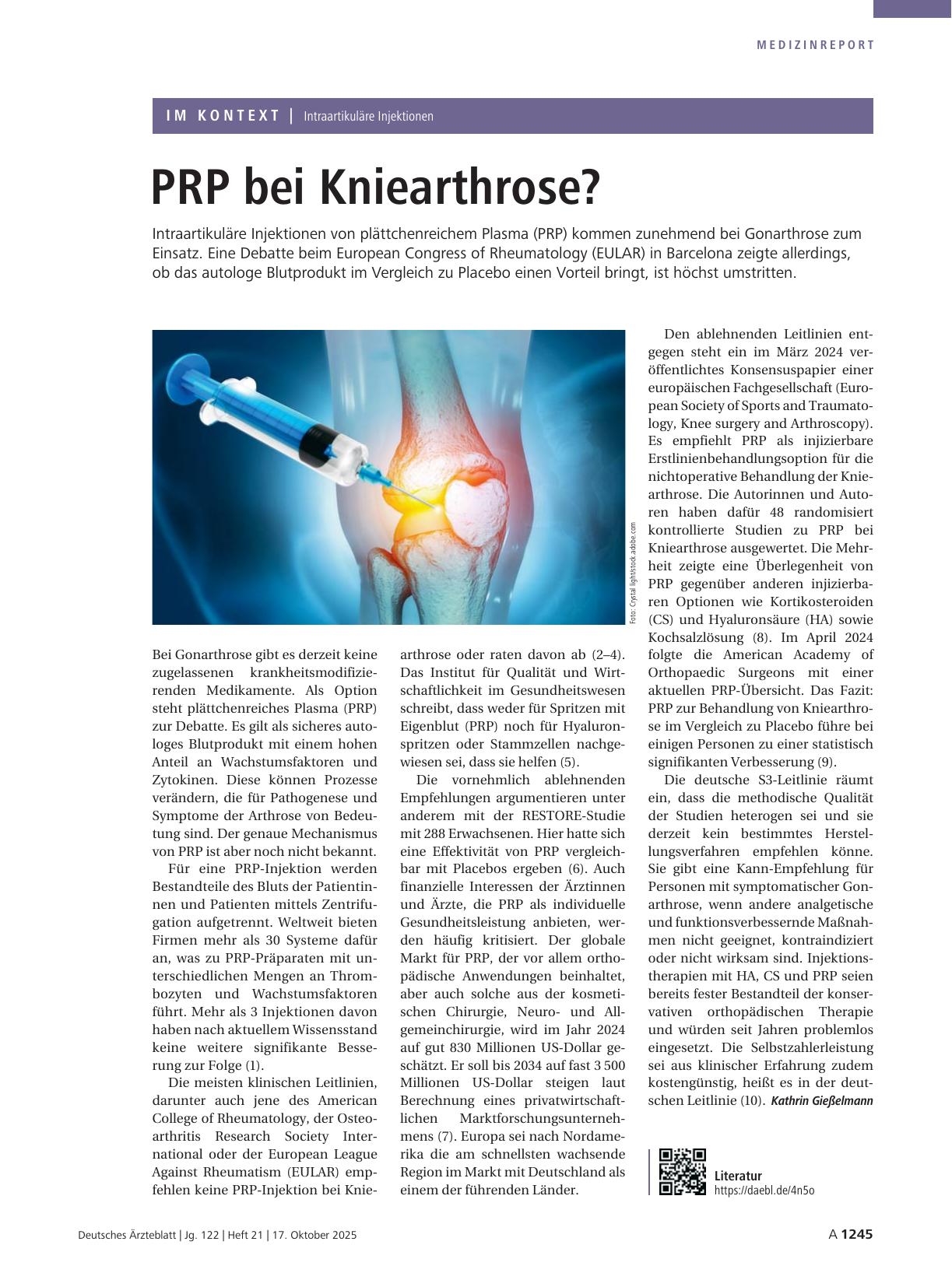 Vorschauseite 1: Intraartikuläre Injektionen: PRP bei Kniearthrose?
