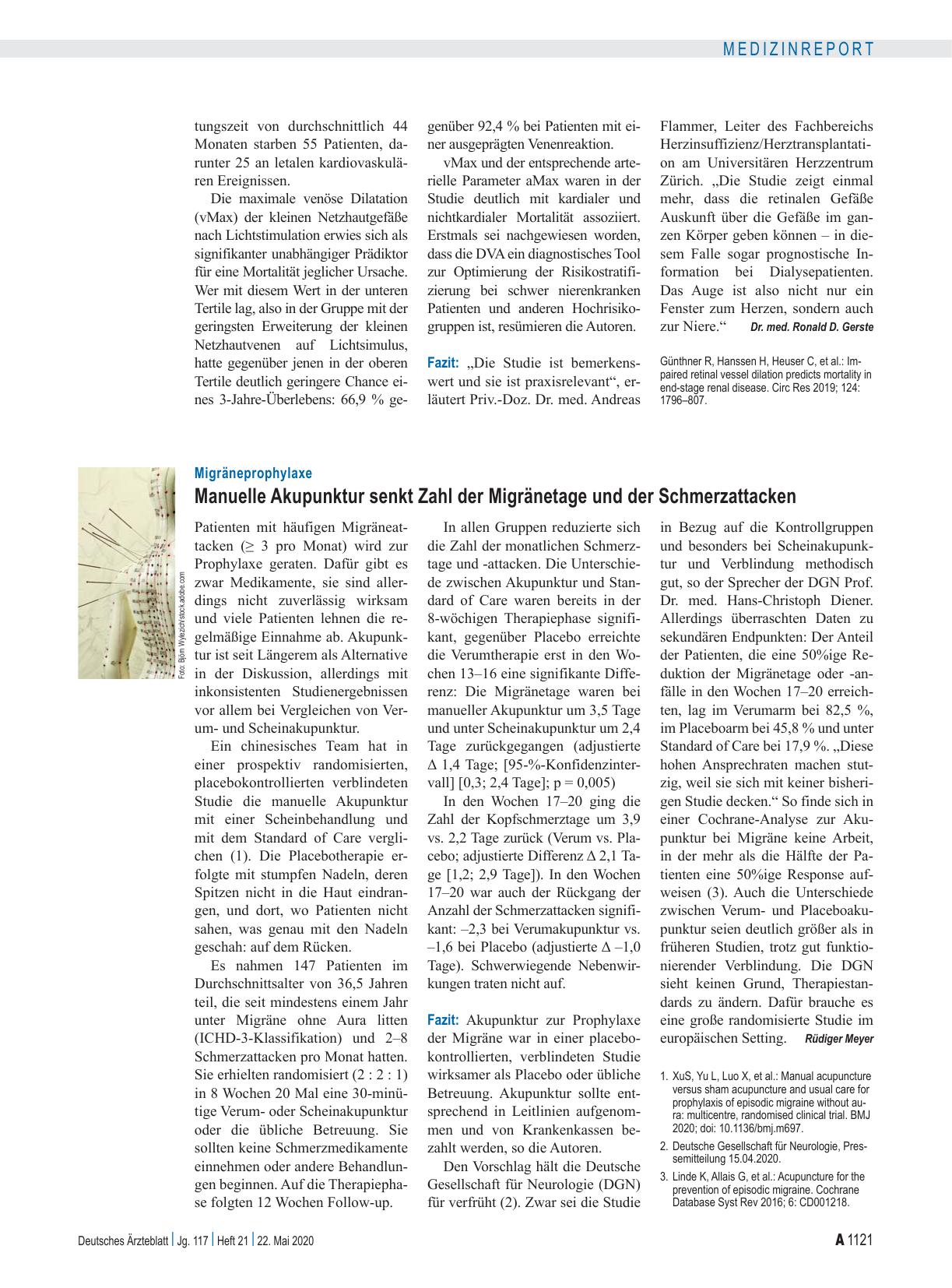 Vorschauseite 1: Migräneprophylaxe: Manuelle Akupunktur senkt Zahl der Migränetage und der Schmerzattacken