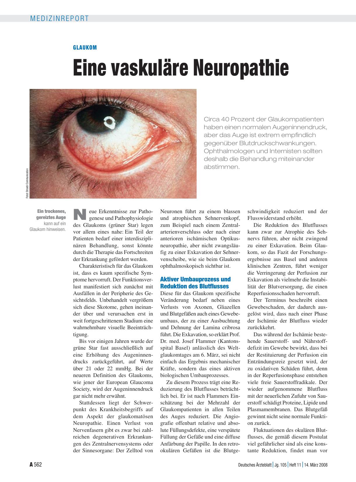 Vorschauseite 1: Glaukom: Eine vaskuläre Neuropathie