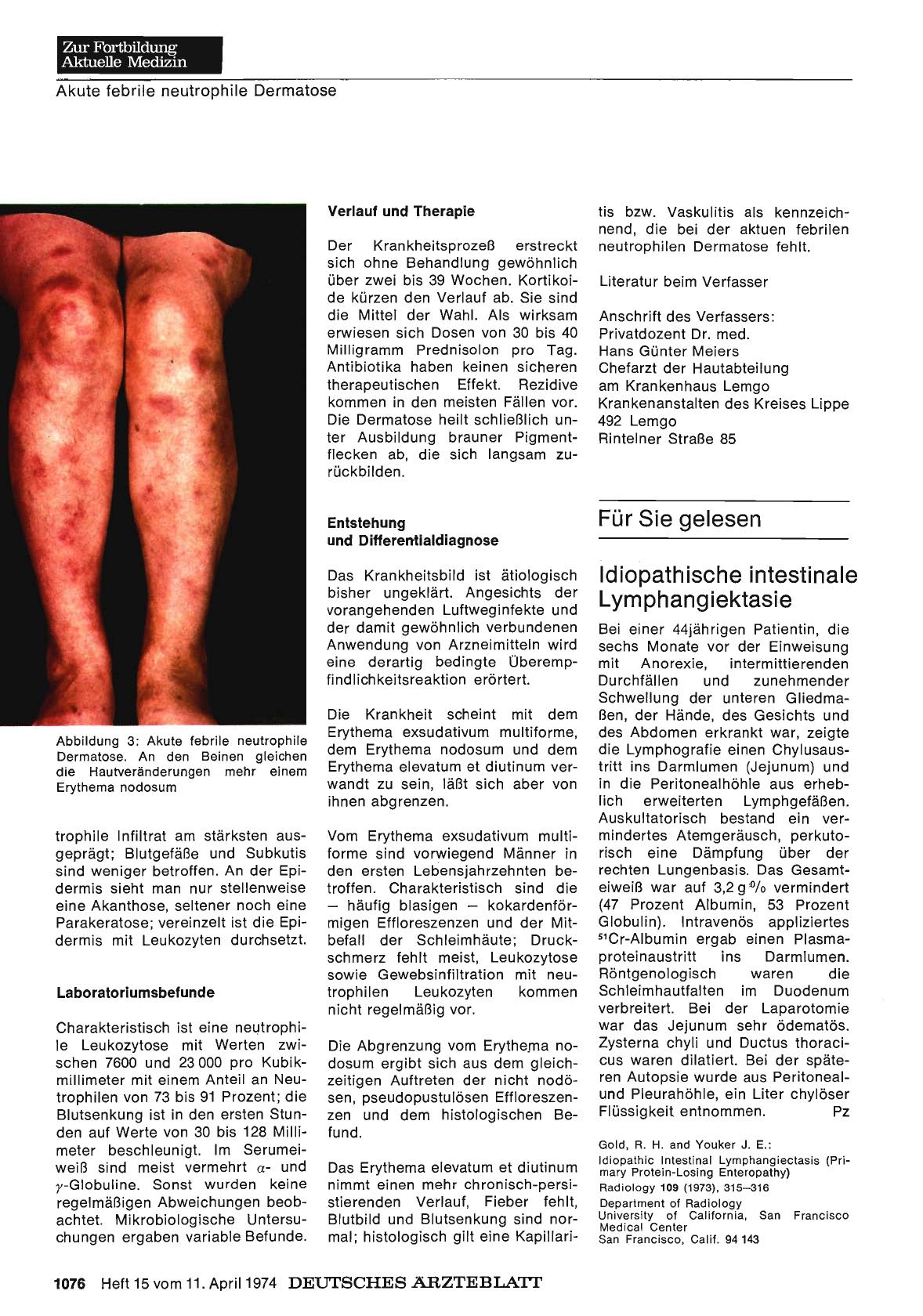 Vorschauseite 1: Idiopathische intestinale Lymphangiektasie