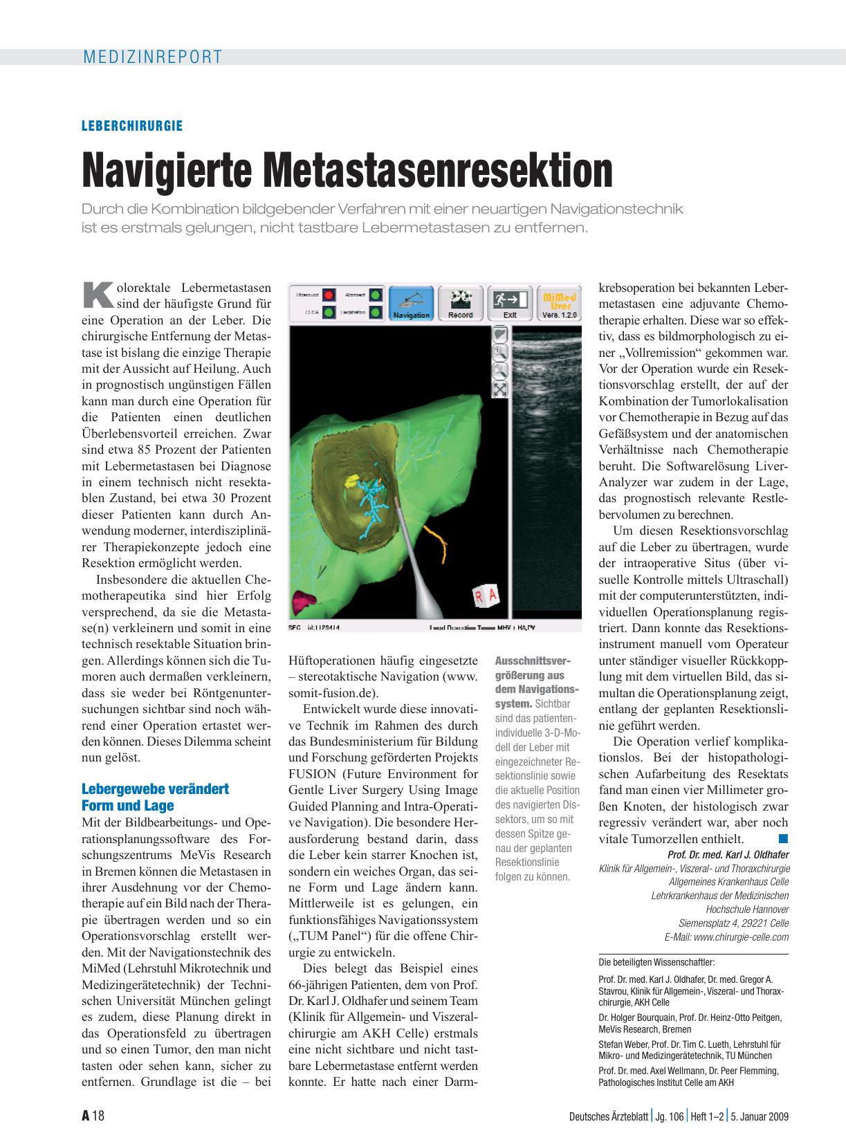 Vorschauseite 1: Leberchirurgie: Navigierte Metastasenresektion