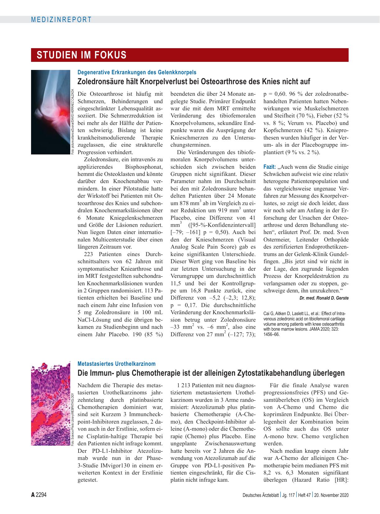 Vorschauseite 1: Metastasiertes Urothelkarzinom: Die Immunplus Chemotherapie ist der alleinigen Zytostatikabehandlung überlegen