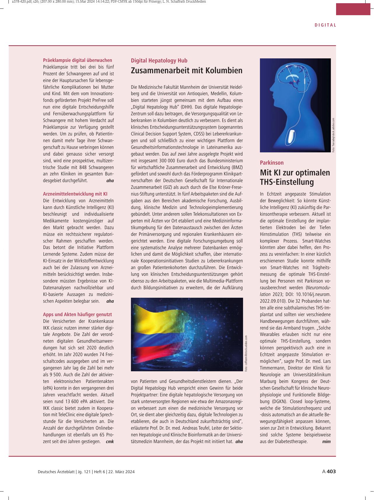 Vorschauseite 1: Parkinson: Mit KI zur optimalen DBS-Einstellung