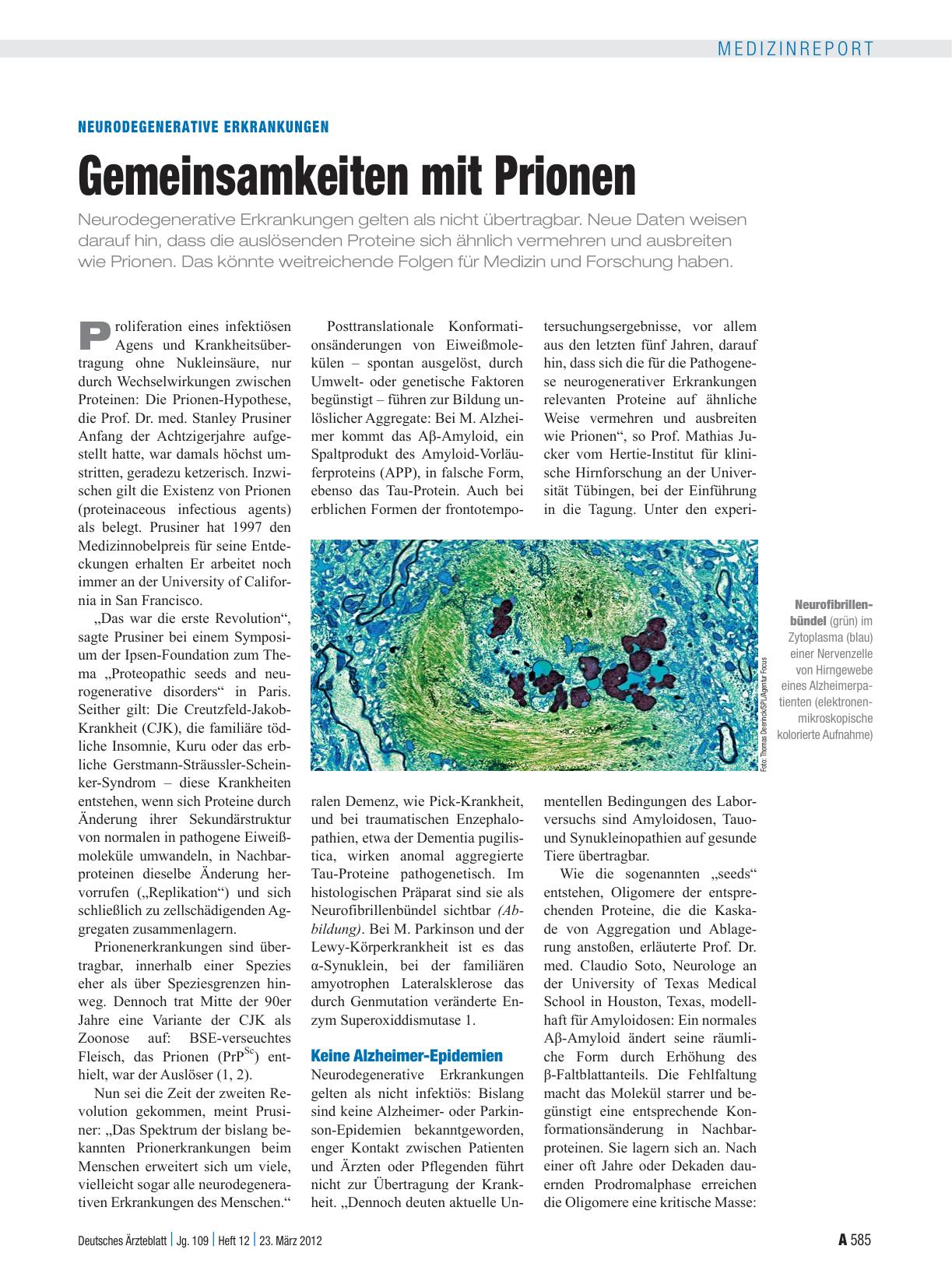 Vorschauseite 1: Neurodegenerative Erkrankungen: Gemeinsamkeiten mit Prionen