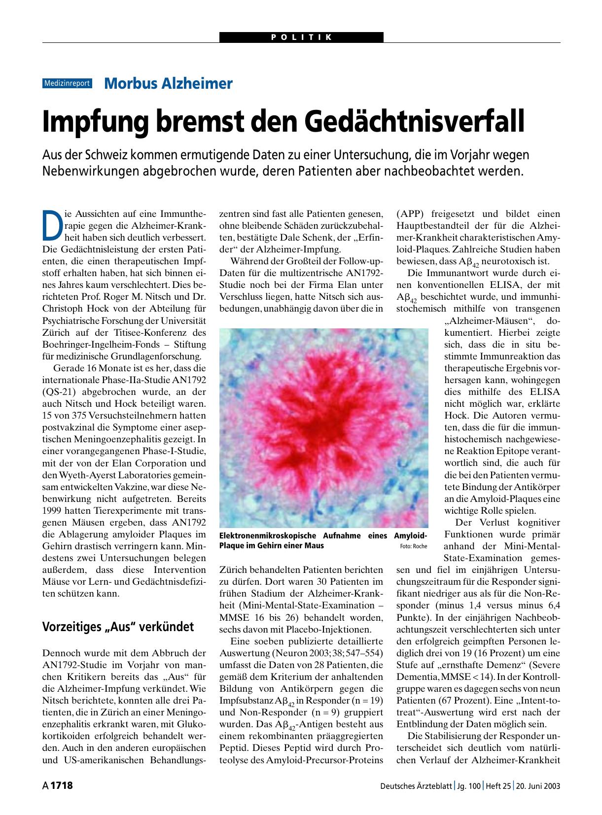 Vorschauseite 1: Morbus Alzheimer: Impfung bremst den Gedächtnisverfall