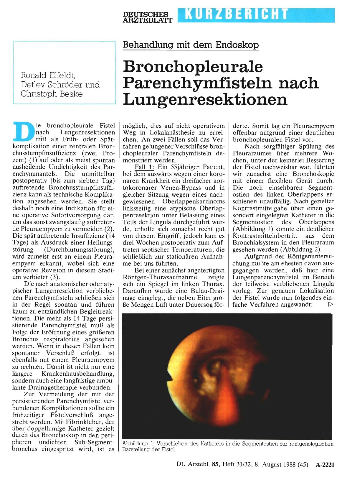 Vorschauseite 1: Behandlung mit dem Endoskop: Bronchopleurale Parenchymfisteln nach Lungenresektionen