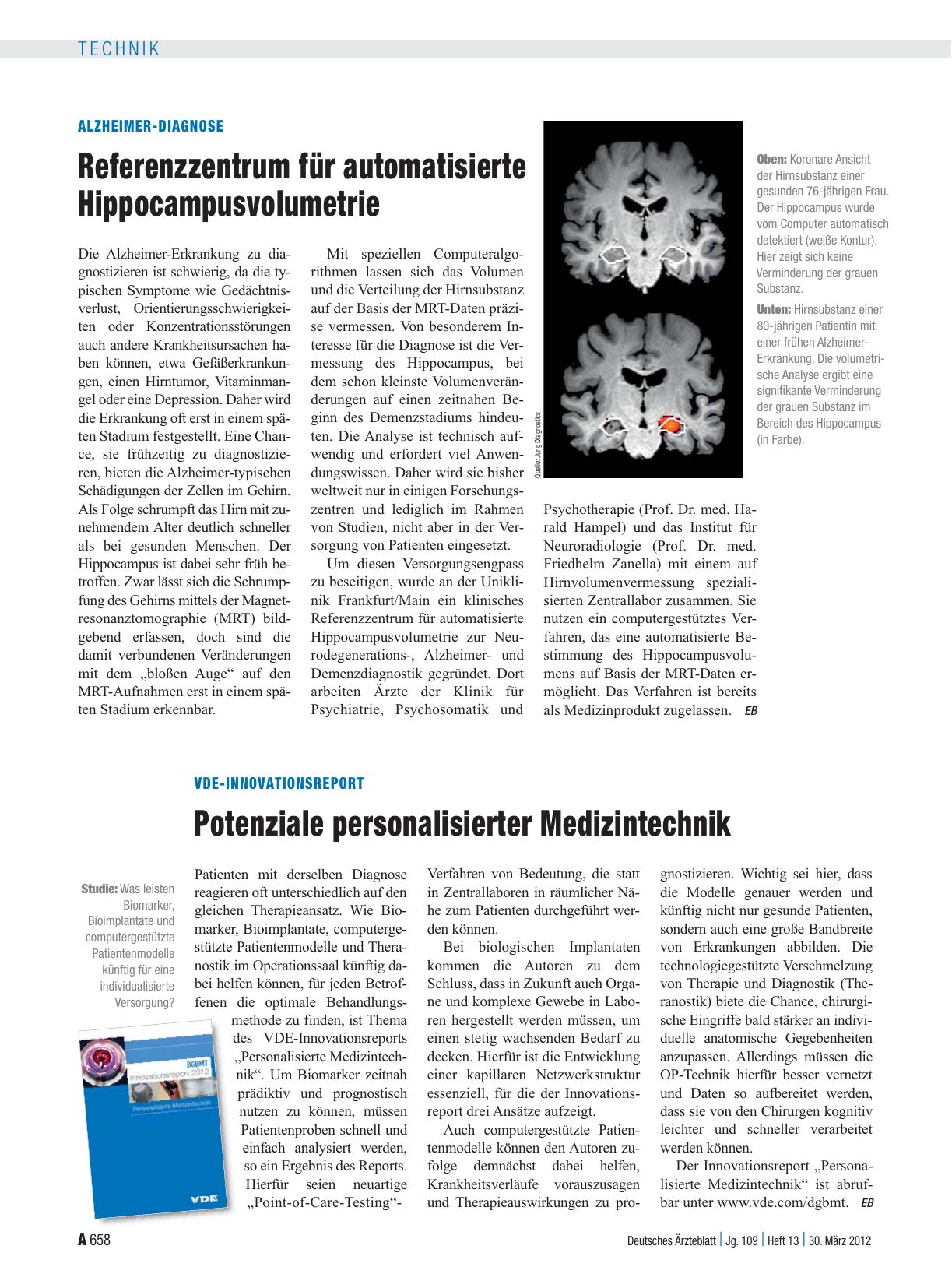 Vorschauseite 1: VDE-Innovationsreport: Potenziale personalisierter Medizintechnik