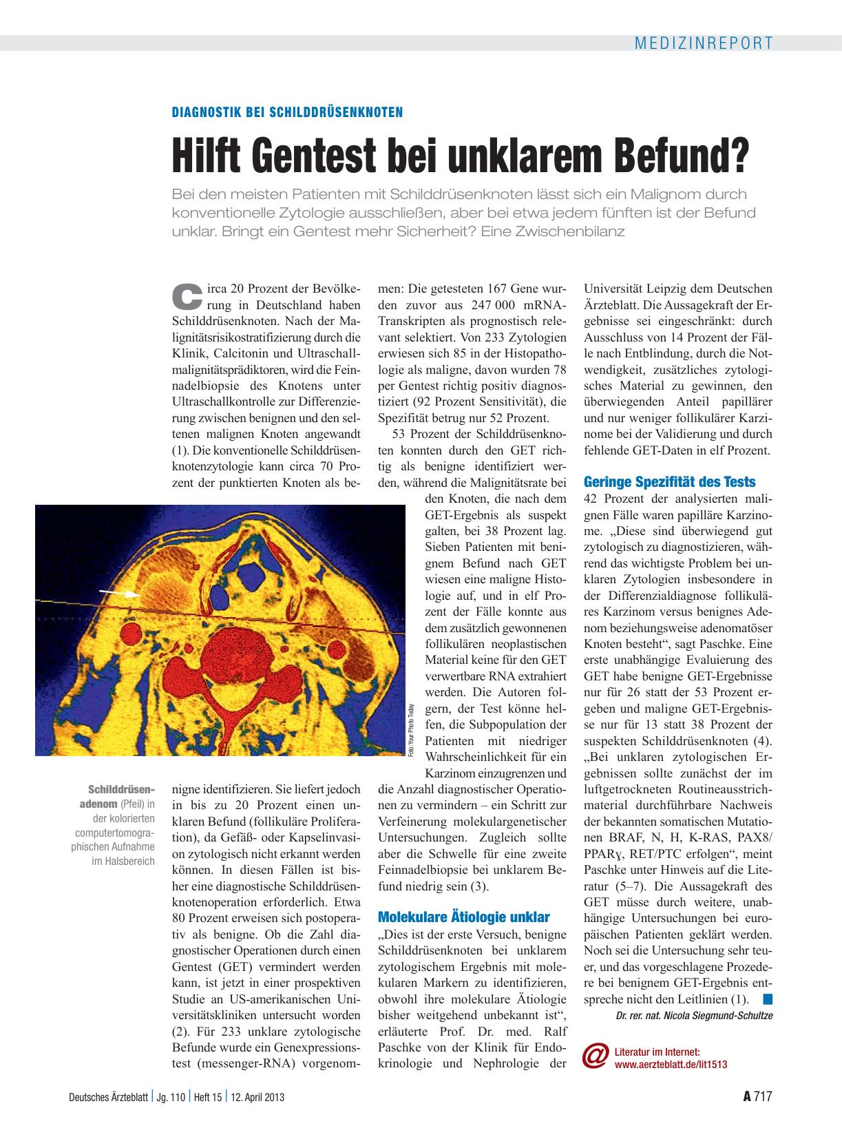 Vorschauseite 1: Diagnostik bei Schilddrüsenknoten: Hilft Gentest bei unklarem Befund?