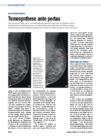 Vorschauseite 1: Brustkrebsscreening: Tomosynthese ante portas