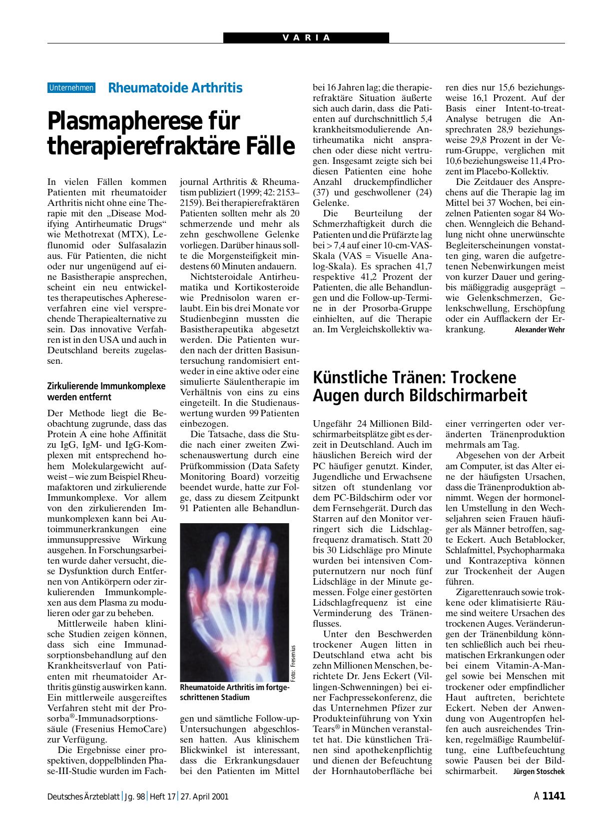 Vorschauseite 1: Künstliche Tränen: Trockene Augen durch Bildschirmarbeit