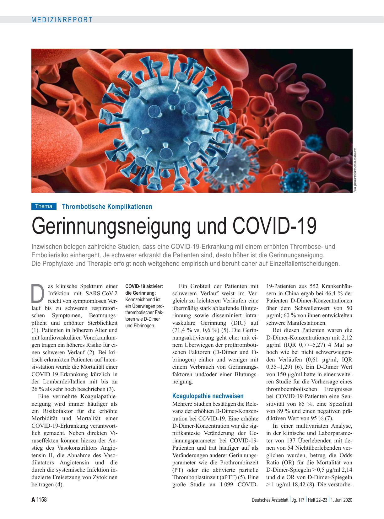 Vorschauseite 1: Thrombotische Komplikationen: Gerinnungsneigung und COVID-19