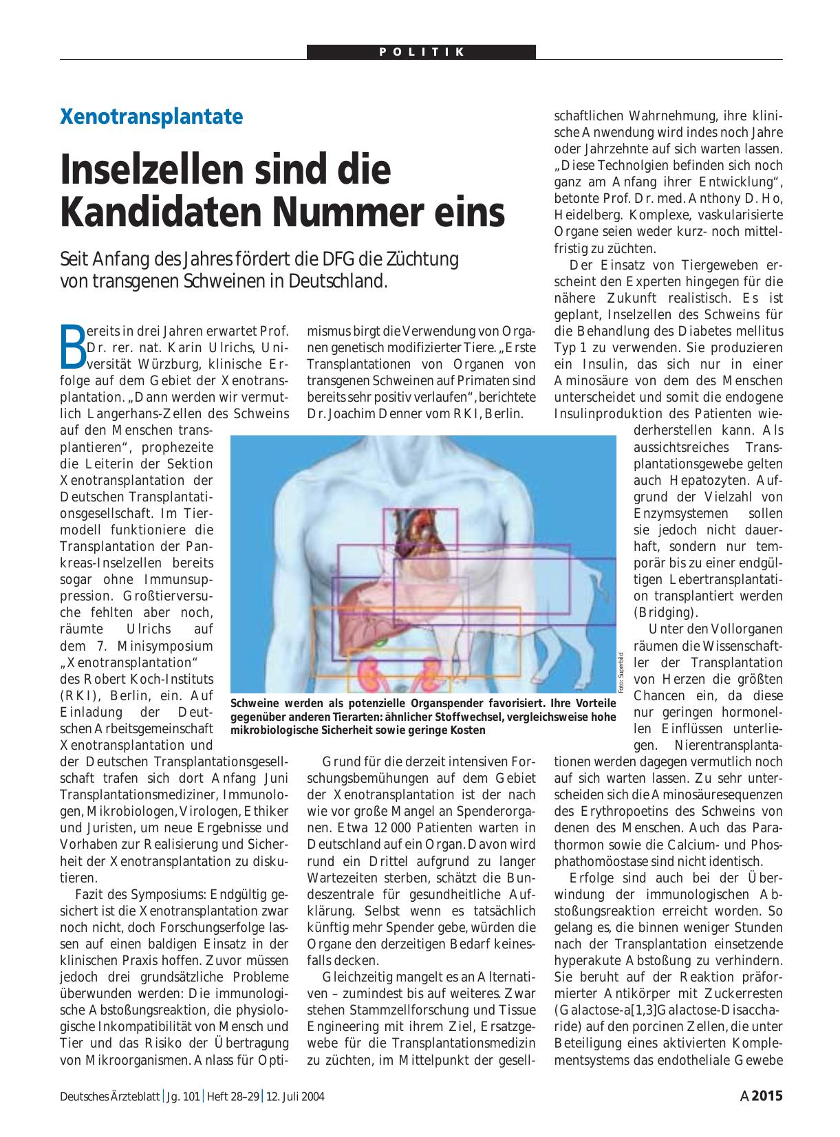 Vorschauseite 1: Xenotransplantate: Inselzellen sind die Kandidaten Nummer eins