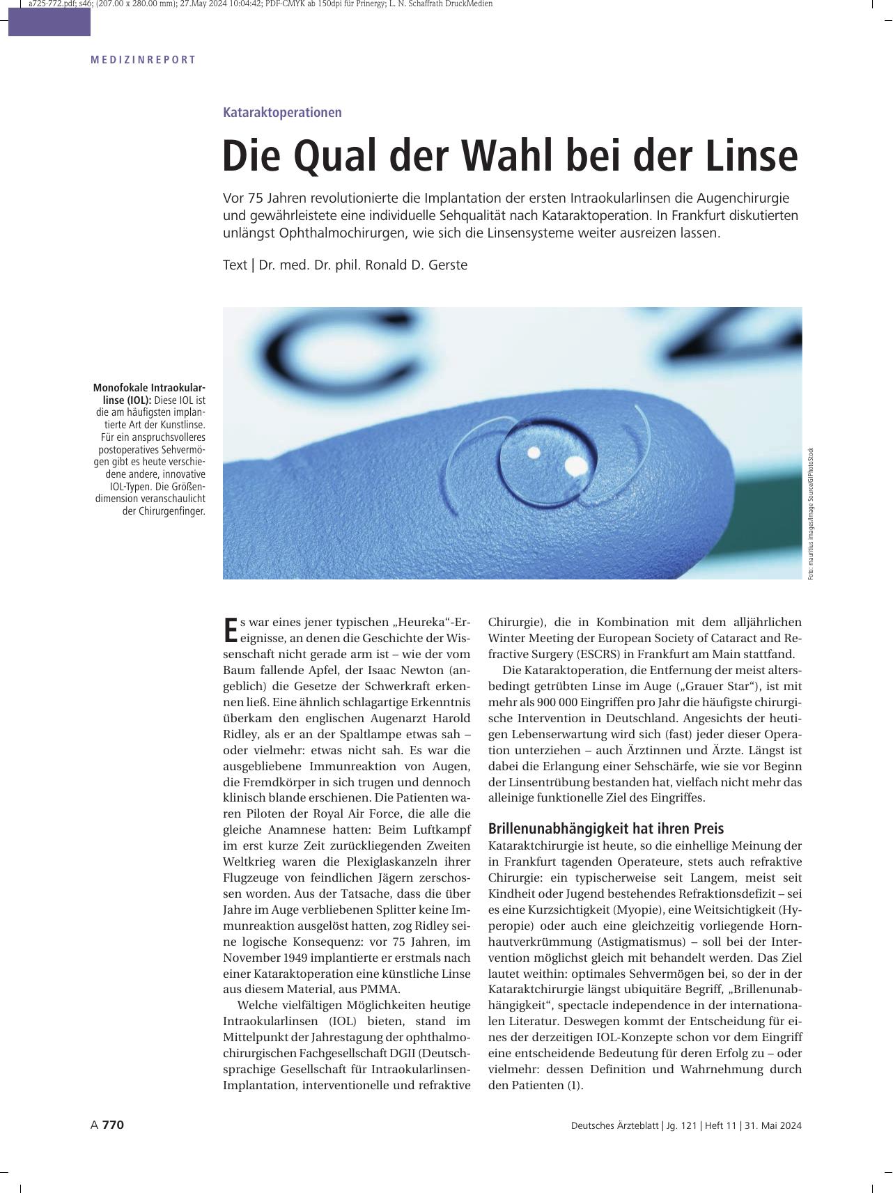 Vorschauseite 1: Kataraktoperationen: Die Qual der Wahl bei der Linse