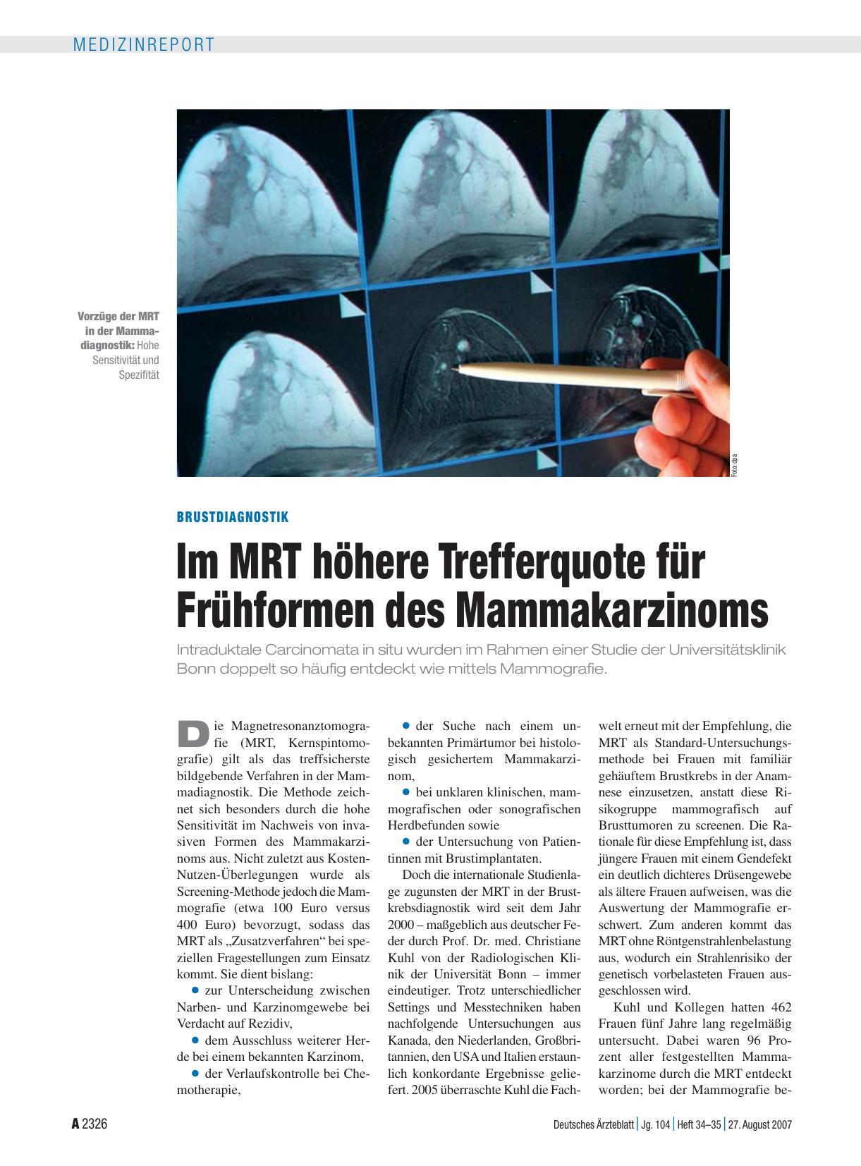 Vorschauseite 1: Brustdiagnostik: Im MRT höhere Trefferquote für Frühformen des Mammakarzinoms