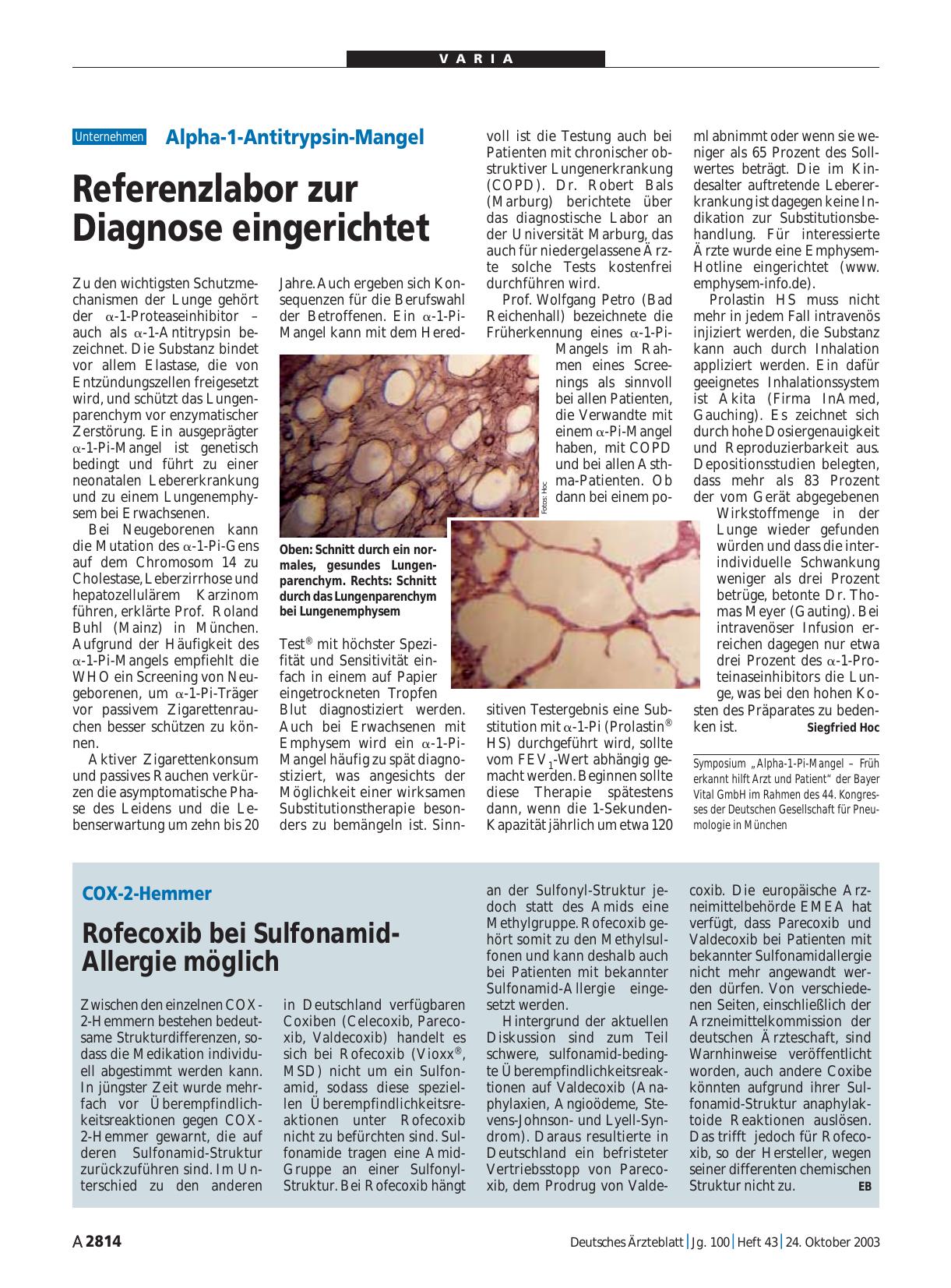 Vorschauseite 1: Alpha-1-Antitrypsin-Mangel: Referenzlabor zur Diagnose eingerichtet