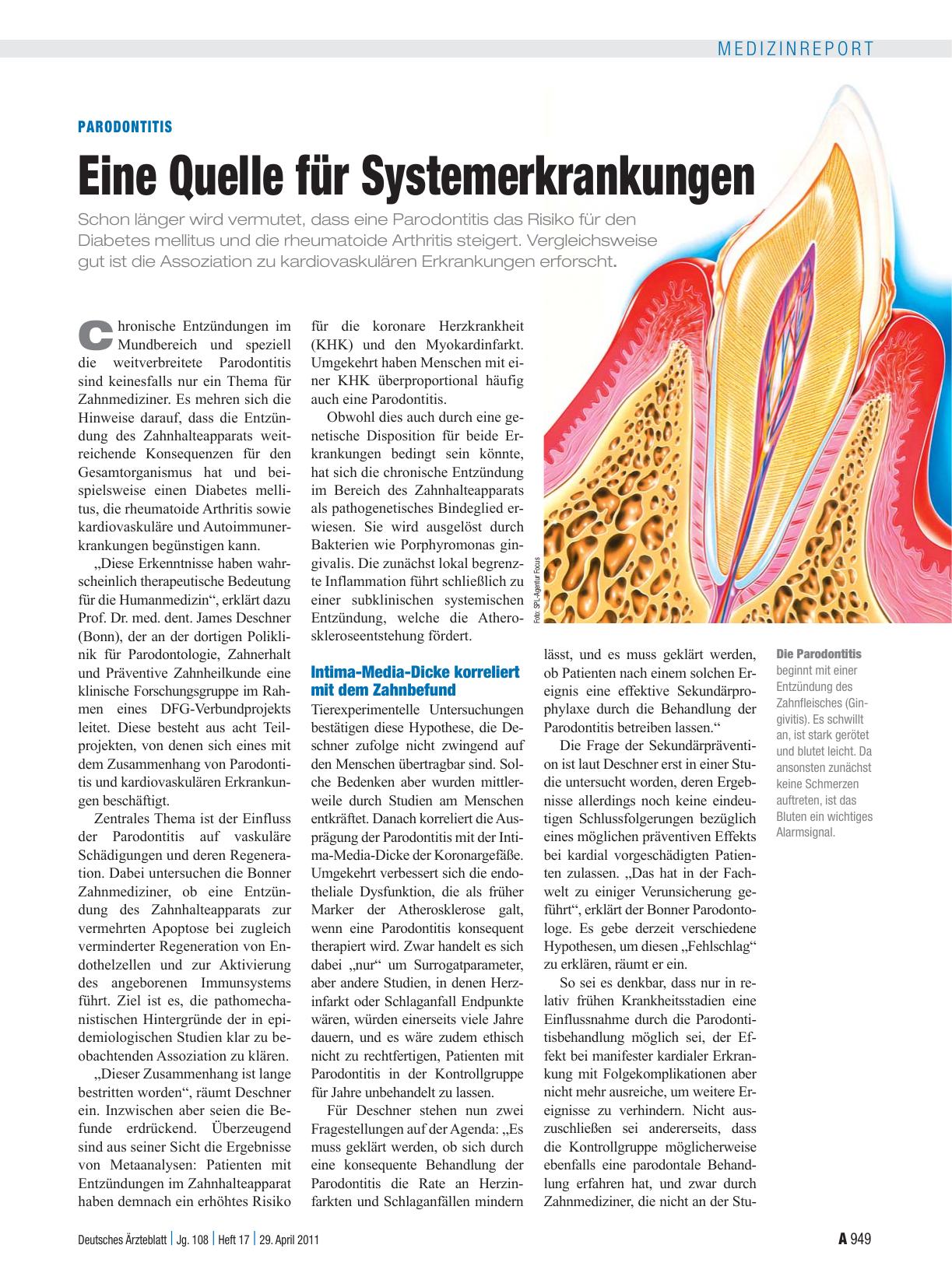 Vorschauseite 1: Parodontitis: Eine Quelle für Systemerkrankungen