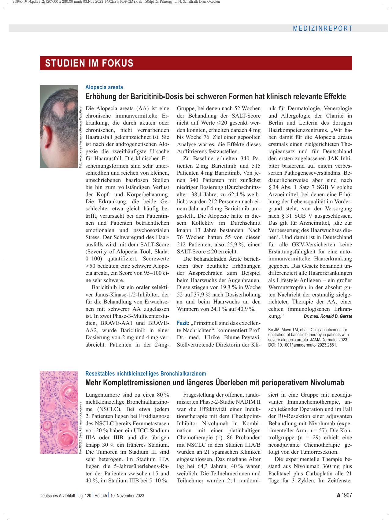 Vorschauseite 1: Alopecia areata: Erhöhung der Baricitinib-Dosis bei schweren Formen hat klinisch relevante Effekte.