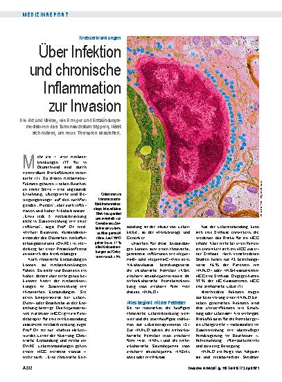 Vorschauseite 1: Krebserkrankungen: Über Infektion und chronische Inflammation zur Invasion