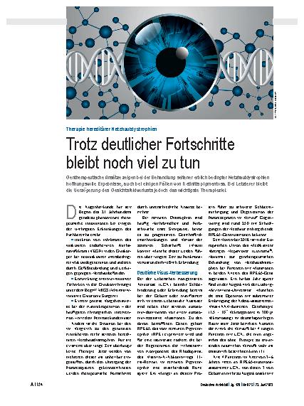 Vorschauseite 1: Therapie hereditärer Netzhautdystrophien: Trotz deutlicher Fortschritte bleibt noch viel zu tun