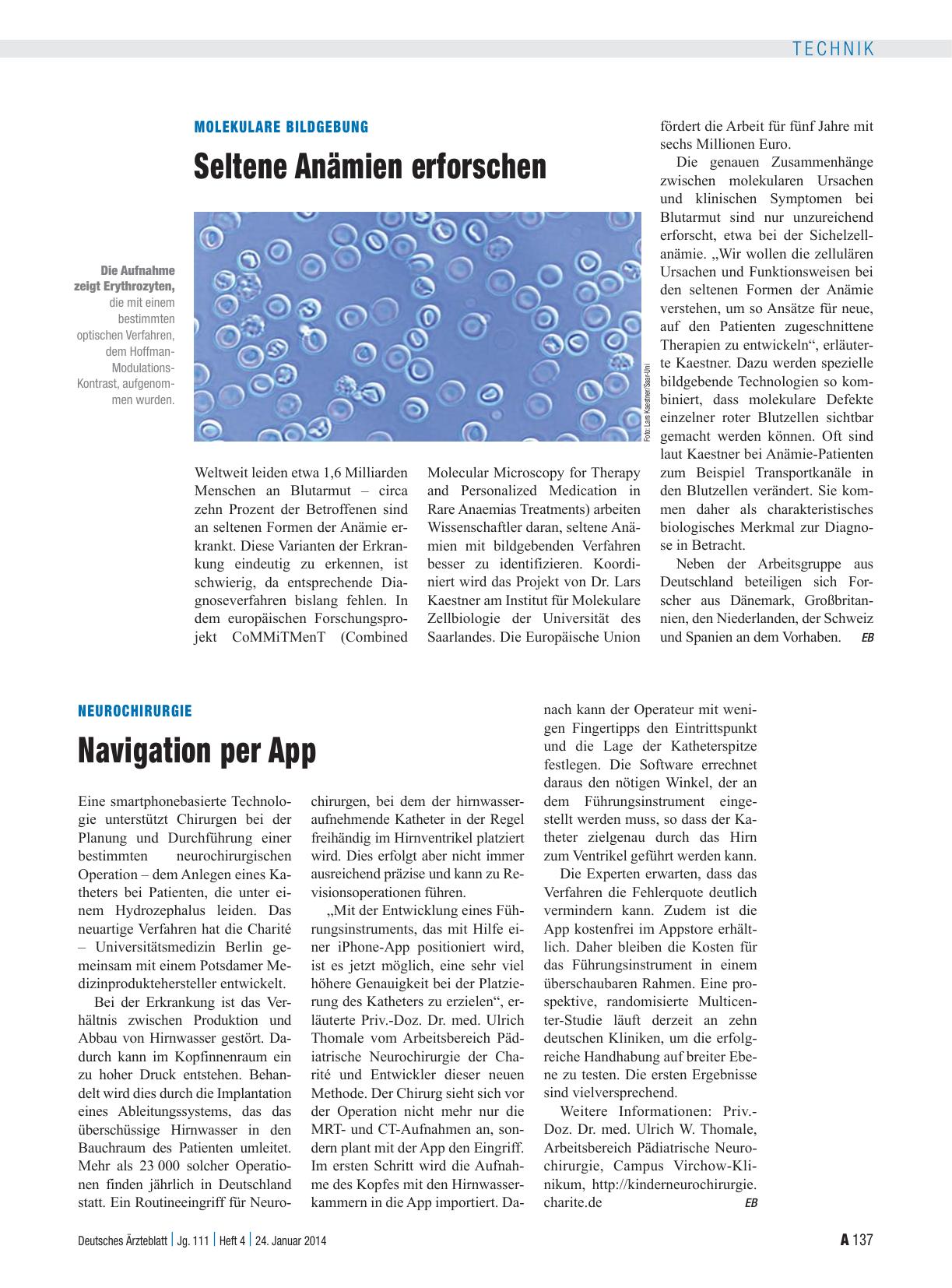 Vorschauseite 1: Neurochirurgie: Navigation per App