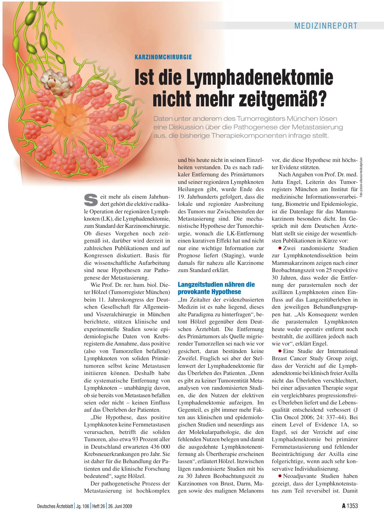 Vorschauseite 1: Karzinomchirurgie: Ist die Lymphadenektomie nicht mehr zeitgemäß?
