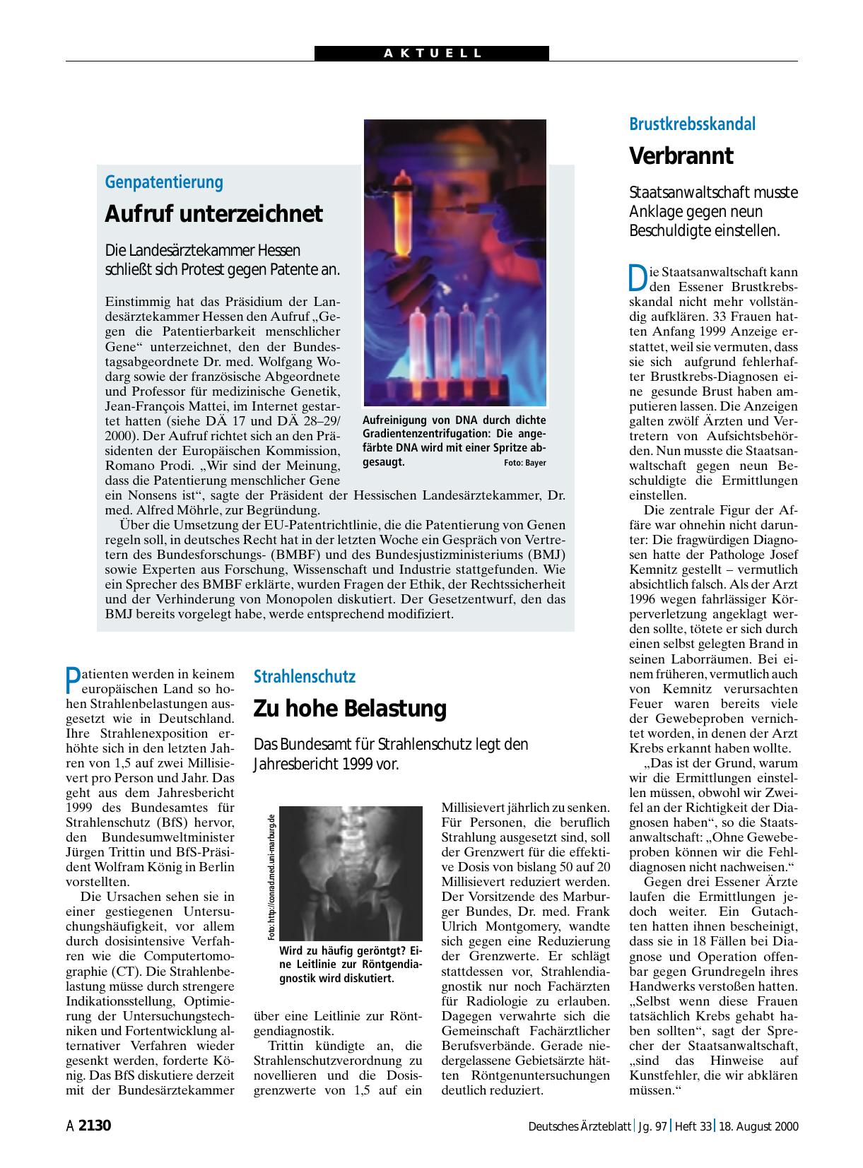 Vorschauseite 1: Brustkrebsskandal: Verbrannt