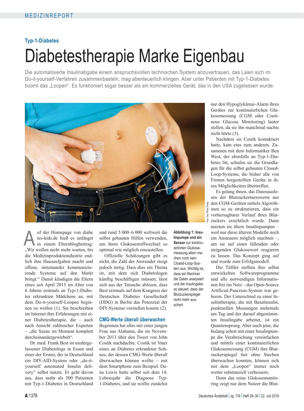 Vorschauseite 1: Typ-1-Diabetes: Diabetestherapie Marke Eigenbau