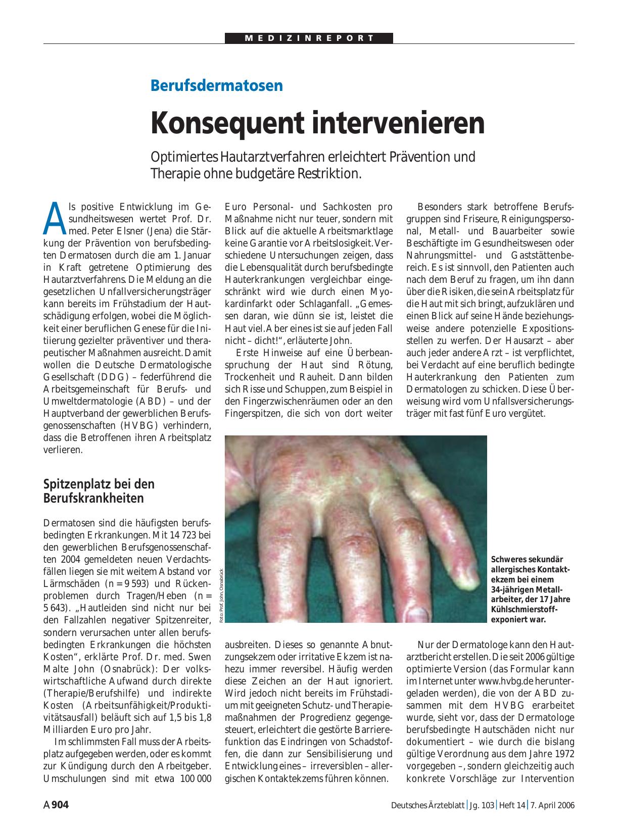 Vorschauseite 1: Berufsdermatosen: Konsequent intervenieren