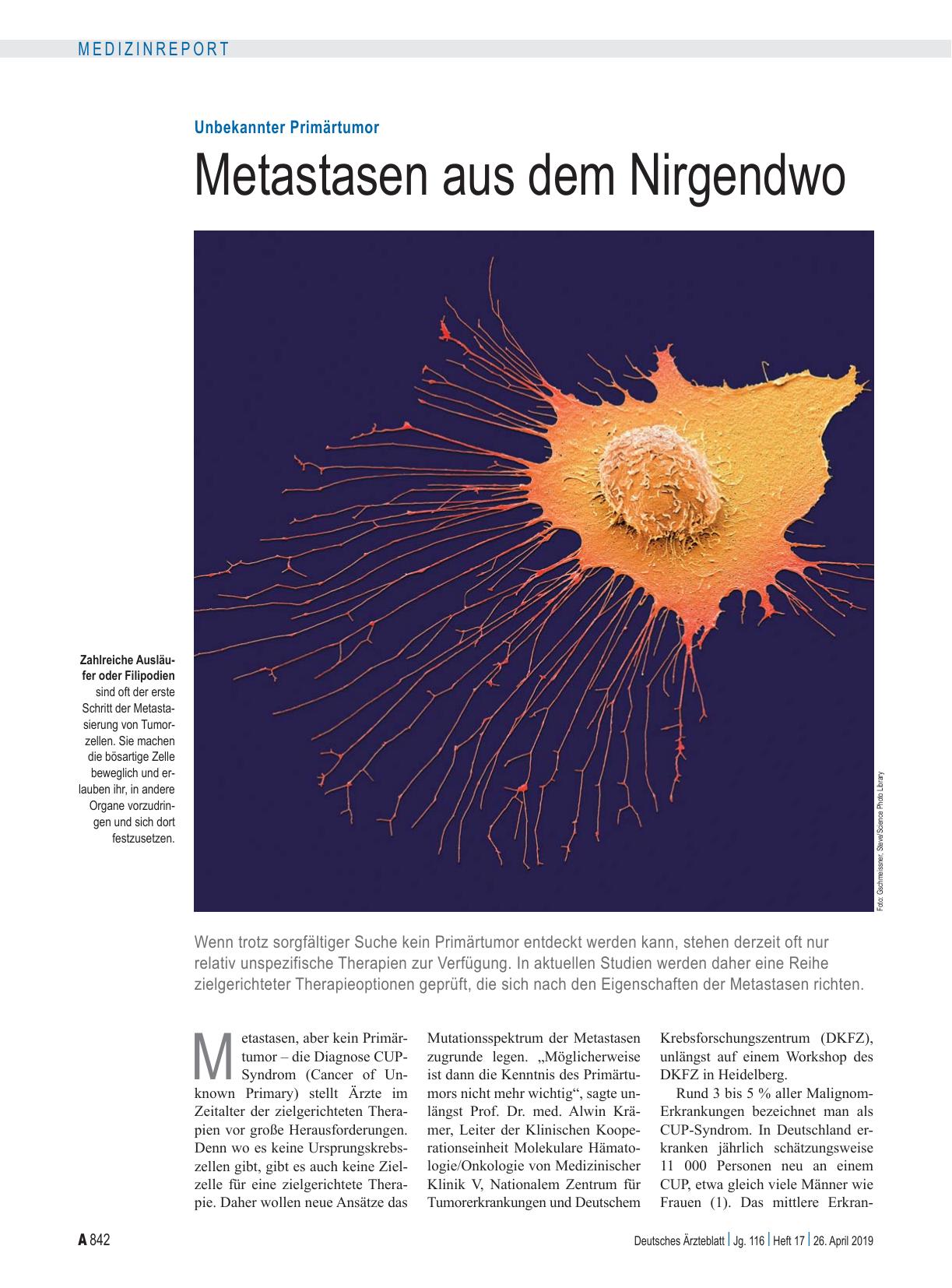 Vorschauseite 1: Unbekannter Primärtumor: Metastasen aus dem Nirgendwo